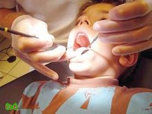 80% من أطفال السعودية يلجأون لتقويم أسنانهم