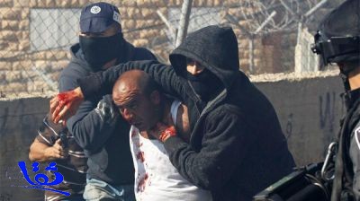 مصادمات عنيفة في القدس بعد صلاة الجمعة