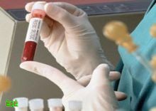 تحليل دم «عشوائي» في سوق تجاري ... يكشف 3 إصابات بـ «الأيدز»