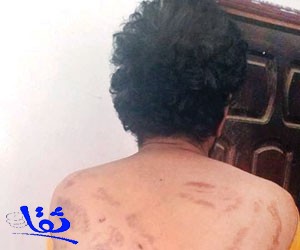 شهادات مروعة عن التعذيب في معتقلات الحوثي