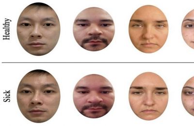 النساء أكثر حساسية لاكتشاف المرض.. بحث علمي يكشف السر التطوري