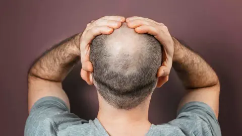 امرأة تتهم زوجها بخداعها وإخفاء "صلعه"