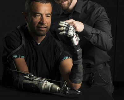 الأطراف الاصطناعية... قفزات متتالية نحو محاكاة الحركة الطبيعية