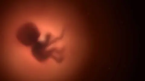 قبل أن يولدوا.. الأجنة يبكون بصمت داخل أرحام أمهاتهم قبل أن يولدوا.. الأجنة يبكون بصمت داخل أرحام أمهاتهم
