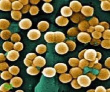 دراسة: «بكتيريا عنقودية» تنتشر تحت أظافر عمال المطاعم
